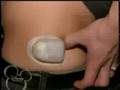 Jonas Brothers Living the Dream Episode 9: Nicks Diabeties
