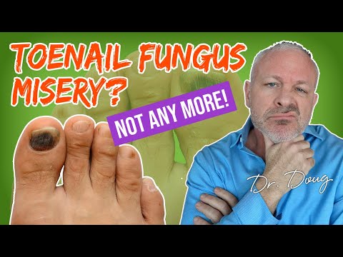 how to kill fingernail fungus