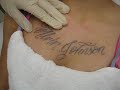 Tatoeage verwijderen Tatoeage verwijderen