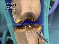 adult-stem-cell-regeneration-animate-.html