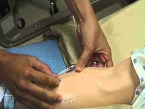 how to assess iv site