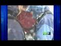 Rescuers-Race-Weathe