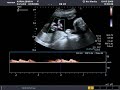 4d echo 06