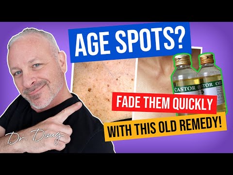 how to eliminate age spots naturally