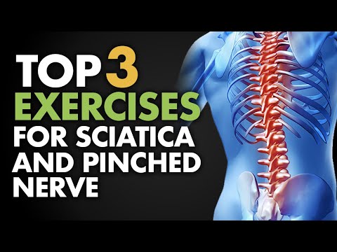 how to relieve a sciatic nerve that is pinched