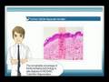 MOSAIC Laser treatment... View Video