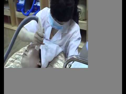 how to use rf skin tightening system