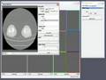 HipOp planning software (1)