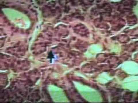 Salivary Glands & Pancreas Lab Part ...