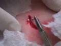 Sam gets stiches