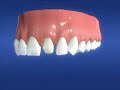 Dr Fox - Crowns Dr Fox - Crowns