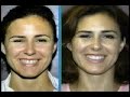 new advancements in cosmetic dentistry