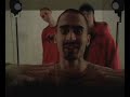 Syndrom snop