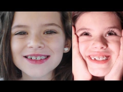 Emma - Follow us! http://www.twitter.com/kittiesmamayt Another awesome family vlog! This week ... Emma gets braces and we paint the office. OUR LINKS: http://www.tw...