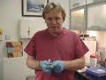 Radiesse for rejuvenating hands