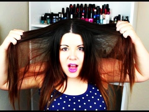 how to get rid of dandruff