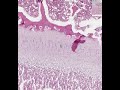 Shotgun Histology Endochondral Ossification