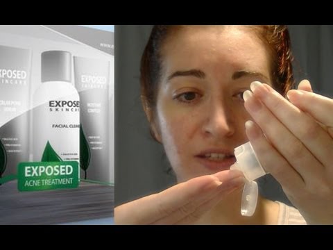how to use exposed skin care