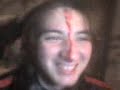 Jason Bleeding O_O