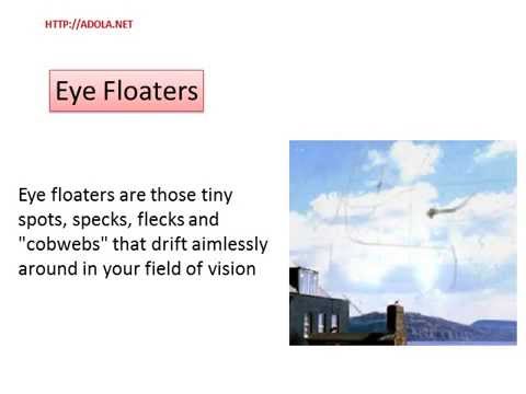 how to dissolve floaters in the eye