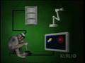 robotic prosthetics