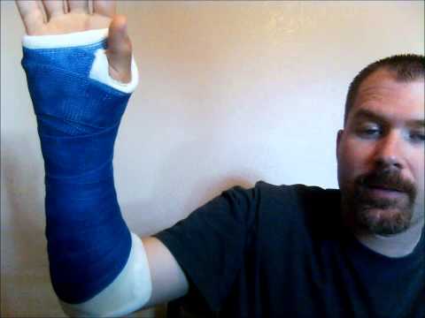 how to repair tfcc tear