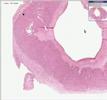 Histopathology Ovary--Normal-corpus luteum