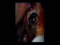 Dental/ENT Microscope