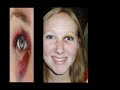 black-eyes-volume-3.html