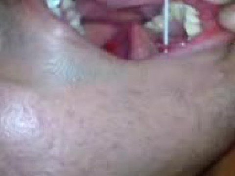 frenulum piercing n_n. mi uniko piercing =( frenulum piercing n_n. mi uniko piercing =(