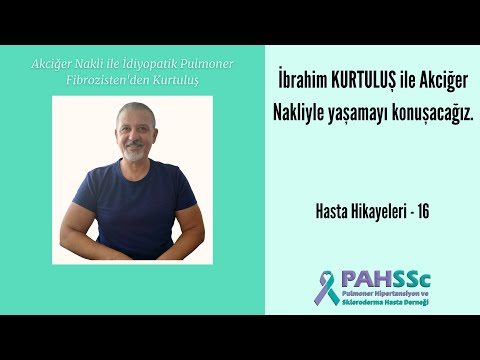 Hasta Hikayeleri - İbrahim KURTULUŞ ile Akciğer Nakliyle Yaşamak - 16 - 2020.09.17