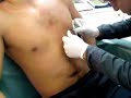 ersin-piercing ersin-piercing