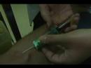 Taking Blood