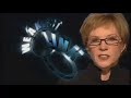 Weakest Link Kobi