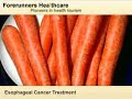 Esophageal Cancer  Cancer Esophageal Cancer