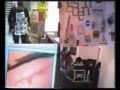 View Video