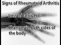 Diagnosing Arthritis (Arthritis #4)