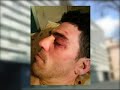 casuística actualidad violaciones dd hh por mossosdesquadra