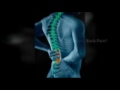 Raceland, LA Back Pain Relief - Dr. Bryan Dufrene