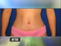 Dr. 90210 - Hobbies &amp; Hustle Episode 1 - Plastic Surgery