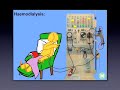 Hemodialysis