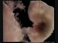 re: Miracles Of Quran 11 baby was a sperm ? allah said ?