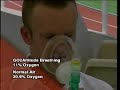 Altitude Training - Intermittent Hypoxic Training