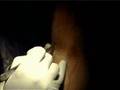 ACL Surgery Dr. Allan Mishra Emedx.com