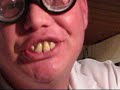 Alfred TV - \"Ich bin doch net Aggressiv\" :-)