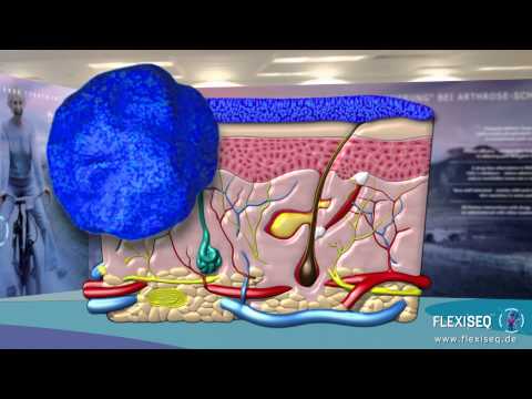 how to apply flexiseq
