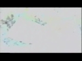 Iraq War Crimes- Depleted Uranium 3 of 4