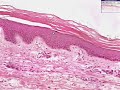 Histología - Piel delgada Histología - Piel delgada