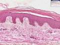 Histología - Piel delgada