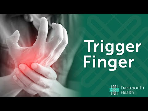 how to relieve trigger finger